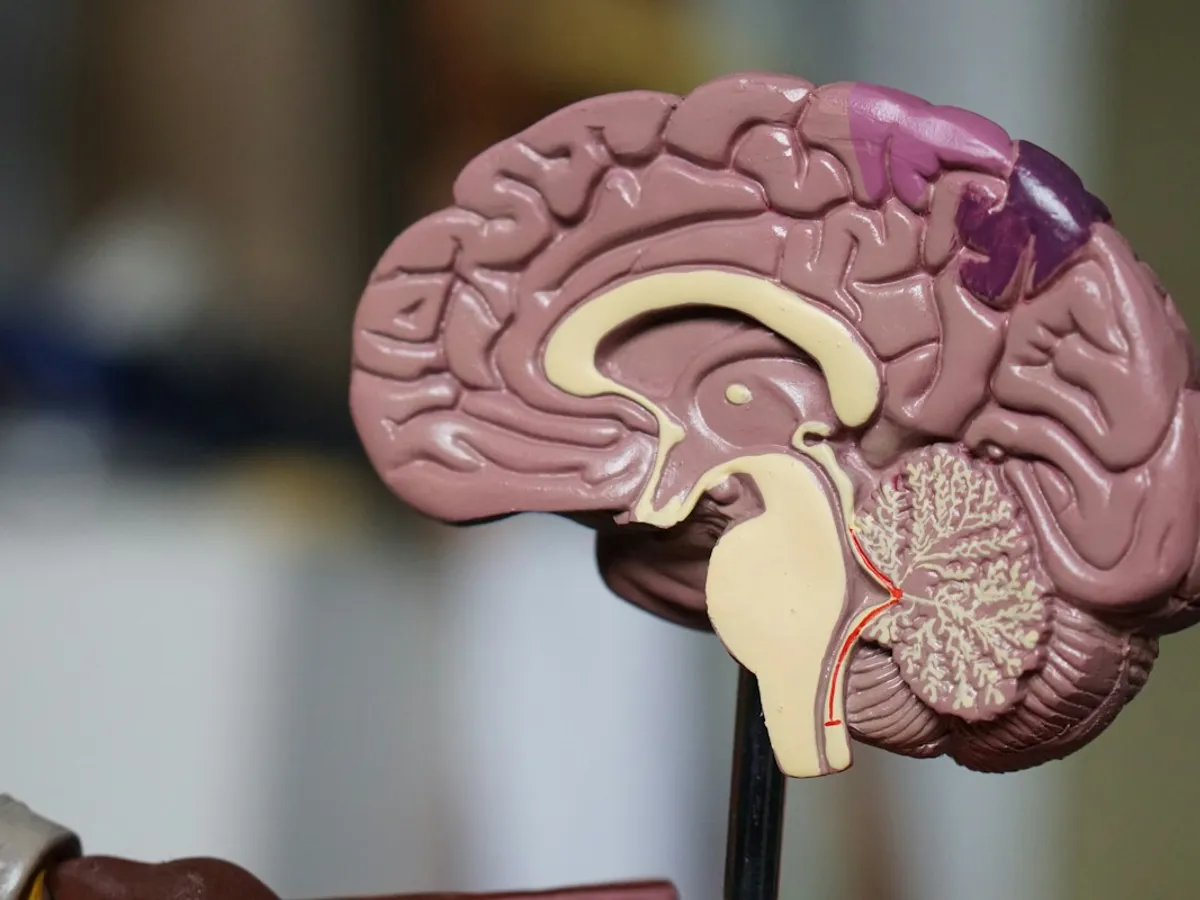 Anatomical brain model used to explain neurological rehabilitation